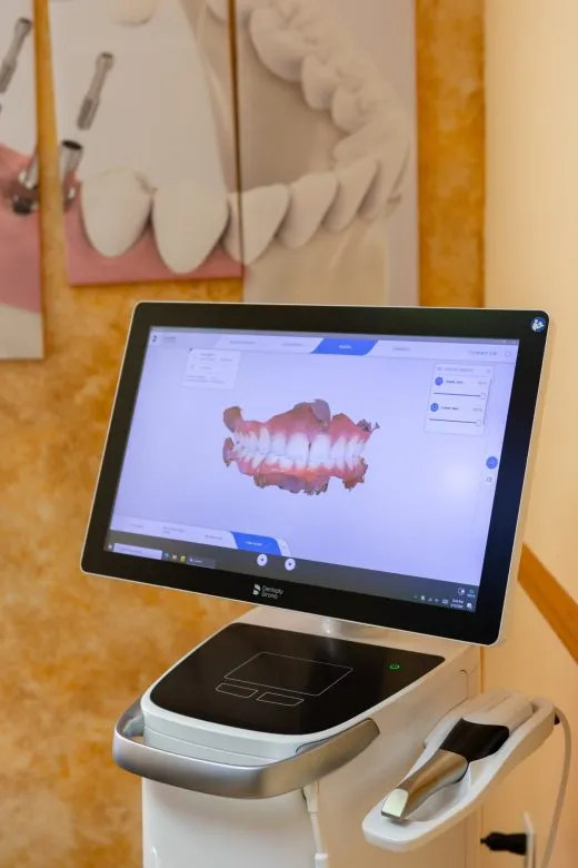 Intraoral Scanner