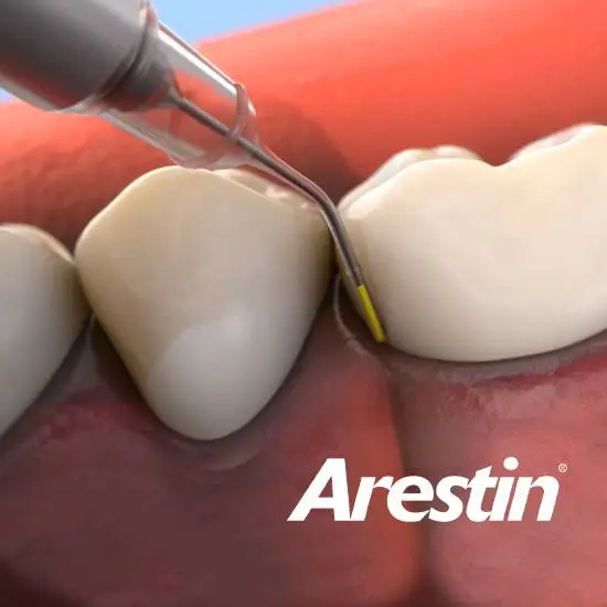 arestin