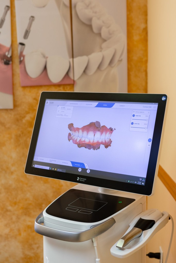 Gums and teeth modeled on a monitor
