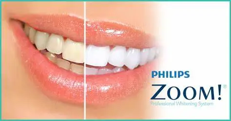 Phillips Zoom! Professional Whitening System